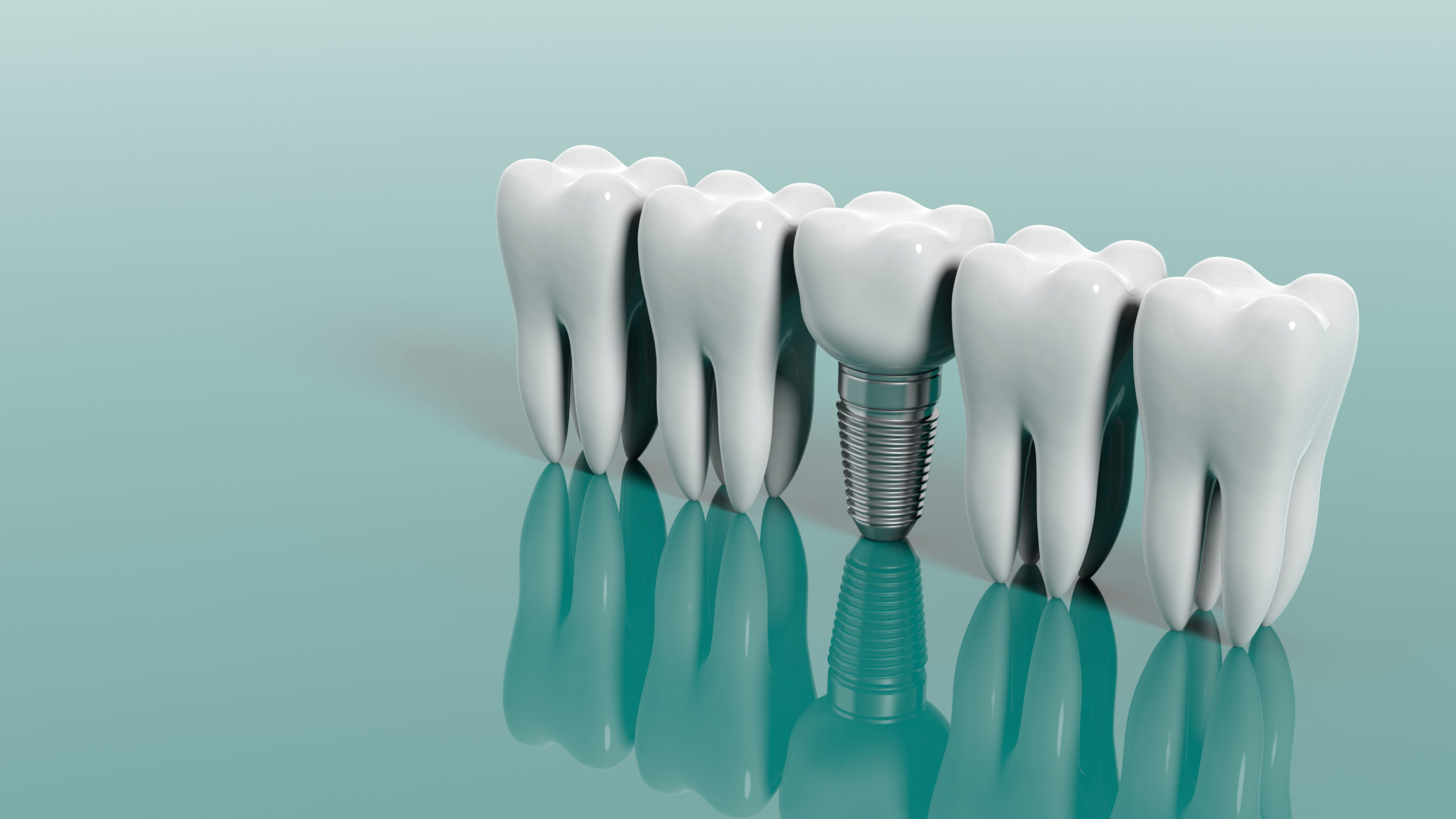 dental implant cost manhattan