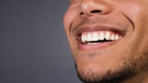 patient smiling after gum disease treatment
