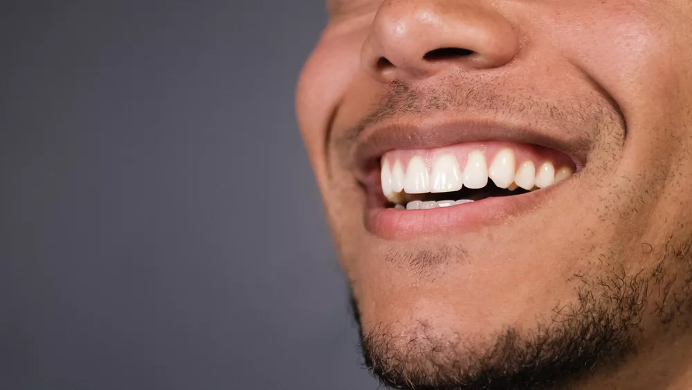 Man Smiling After Gum Grafting