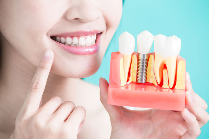 Dental Implant Patient Holding Up A Dental Implant Model And Pointing To Her Mouth