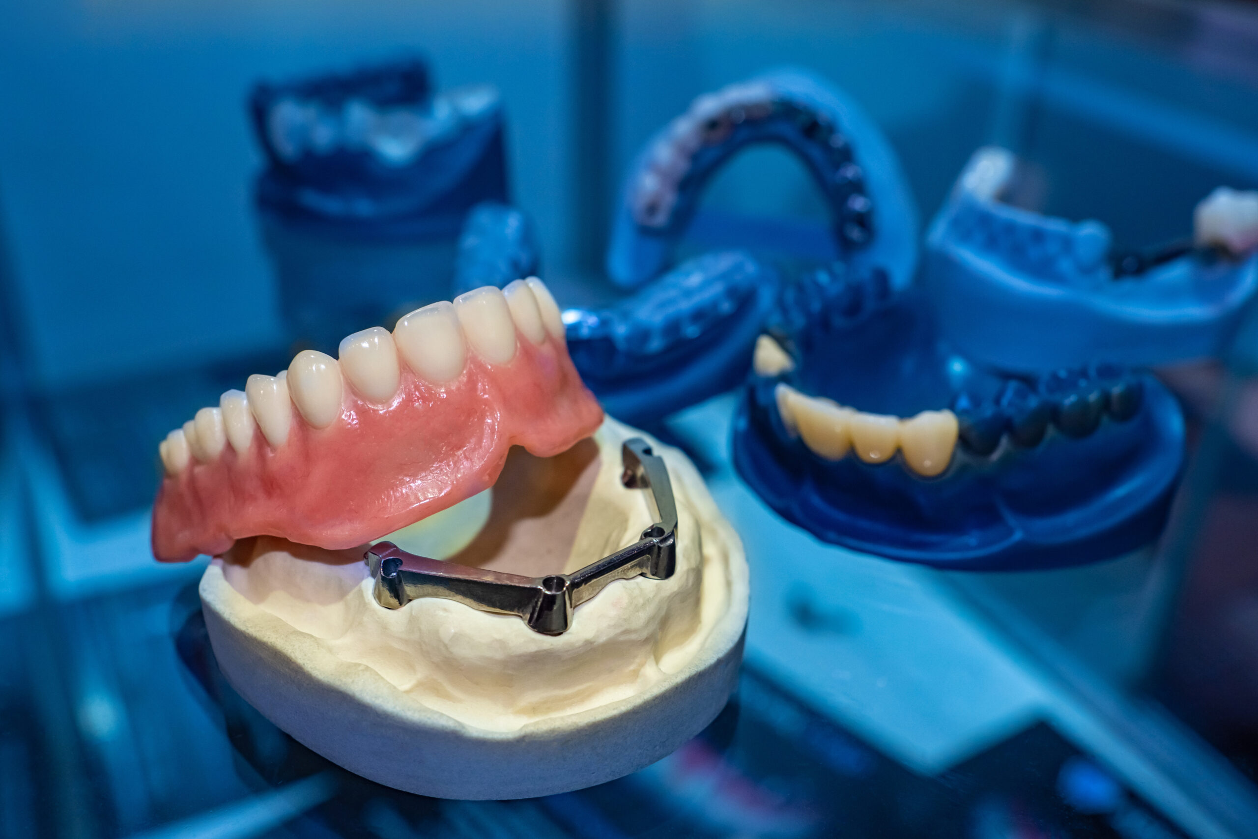 image of a dental implant denture on a prosthesis jaw in a dark and blue lit aesthetic dental room.
